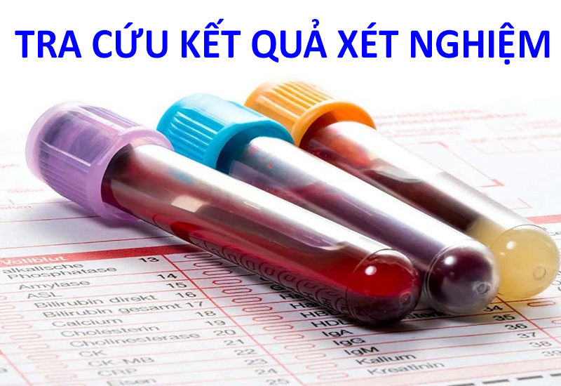 Tra ket qua XN